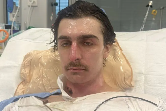 Noch immer schwer gezeichnet von dem Feuer-Unglück. Das ist das neueste Foto, das seine Mutter von Lachie Perrem aus der Klinik auf der Spendenplattform postete.