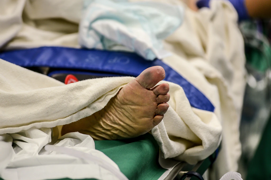 Vergessene Tupfer, Patientenverwechslung: Wenn der Routineeingriff zum Notfall wird