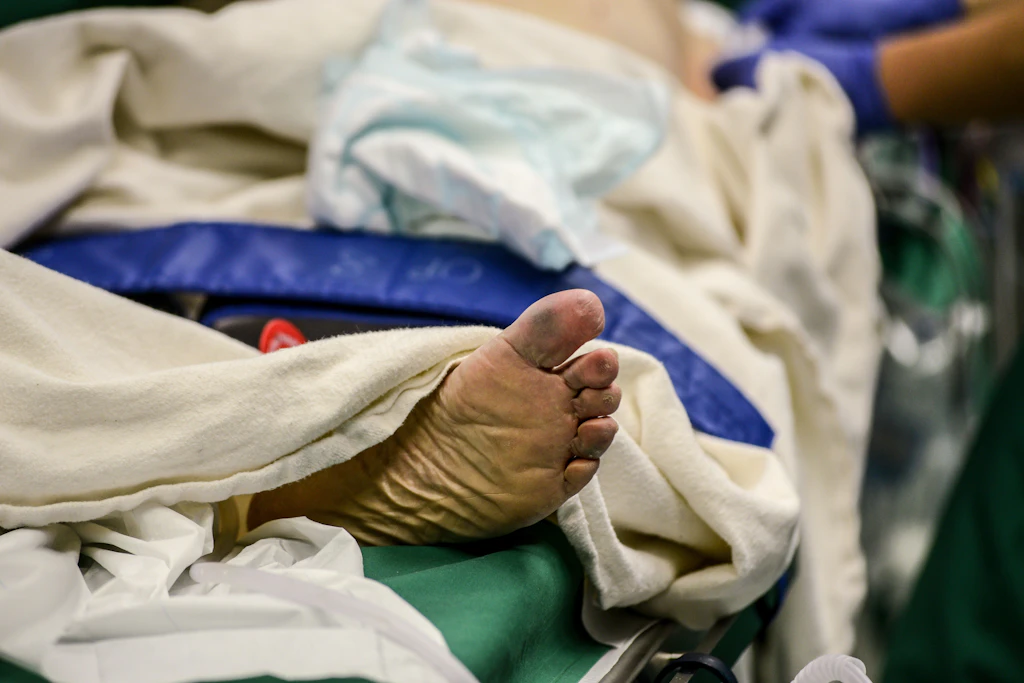 Vergessene Tupfer, Patientenverwechslung: Wenn der Routineeingriff zum Notfall wird