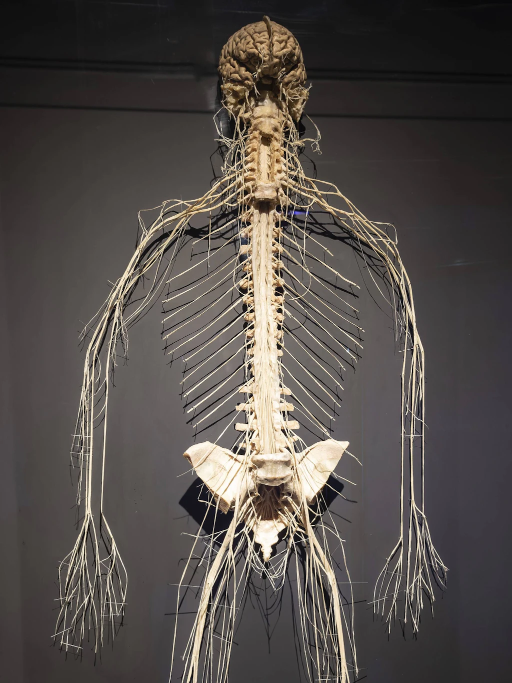 Köperwelten von Gunther von Hagens: das Nervensystem