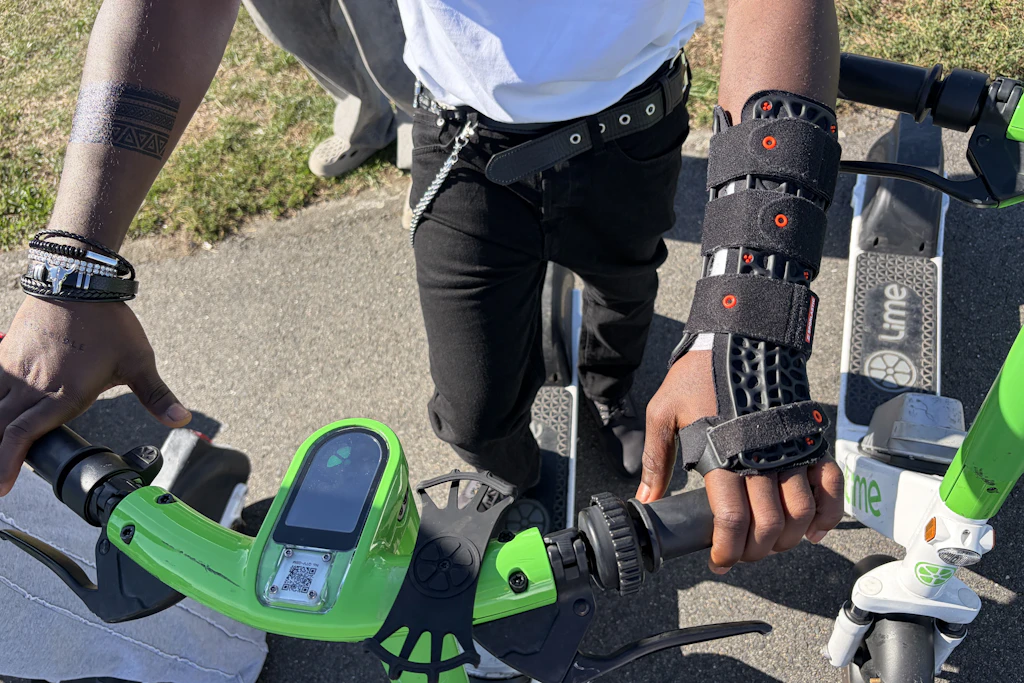 Ein Schüler mit einem gebrochenen Arm durch einen E-Scooter Unfall.