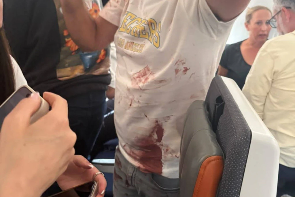 Ein Passagier mit Blutspuren auf seiner Kleidung an Bord von FZ1073 am 30. September. Nach dem Angriff im Cockpit wurde die Maschine nach Saudi-Arabien umgeleitet.